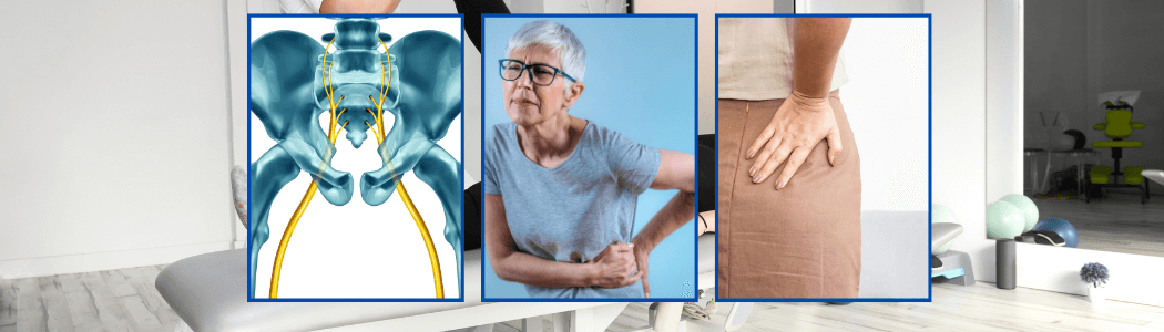 Terapia en casa para aliviar el dolor del nervio ciático